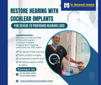Understanding the Benefits of Cochlear Implant Surgery