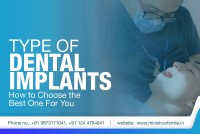 Best Dental Implants Clinic in Gurgaon