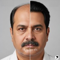 Men’s Hair Wig Shop in Delhi – Raj Hair Wig